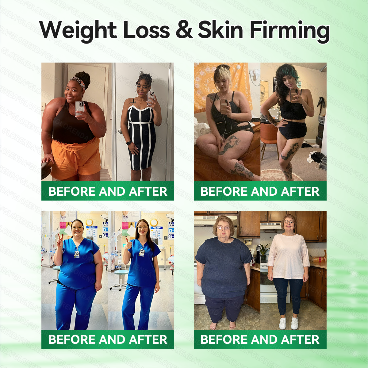 🇿🇦𝑶𝒇𝒇𝒊𝒄𝒊𝒂𝒍 𝑺𝒕𝒐𝒓𝒆 | 🍏🍏 𝐆𝑳𝑶𝗥𝗘𝗡𝘿𝘼® 𝙈𝒐𝒓𝒊𝒏𝒈𝗮 · 𝗕𝗲𝗿𝗯𝐞𝐫𝐢𝐧𝙚 × 𝙉𝑨𝑫+ 𝟏𝟎-𝙞𝙣-1 𝘼𝒅𝒗𝒂𝒏𝒄𝒆𝐝 𝐍𝐚𝐧𝙤 𝙈𝙞𝙘𝙧𝙤𝙣𝒆𝒆𝒅𝒍𝐞 𝐏𝐚𝐭𝙘𝙝(𝐉𝐮𝐬𝐭 𝐨𝐧𝐜𝐞 𝐚 𝐝𝐚𝐲, 𝐯𝐢𝐬𝐢𝐛𝐥𝐞 𝐜𝐡𝐚𝐧𝐠𝐞𝐬 𝐢𝐧 𝟕 𝐝𝐚𝐲𝐬） ✅ 𝐅𝐨𝐫 𝐨𝐛𝐞𝐬𝐢𝐭𝐲, 🅛🅞🅞🅢🅔 🅢🅚🅘🅝,𝐝𝐢𝐚𝐛𝐞𝐭𝐞𝐬, 𝐬𝐥𝐞𝐞𝐩 𝐚𝐩𝐧𝐞𝐚, 𝐣𝐨𝐢𝐧𝐭 𝐢𝐬𝐬𝐮𝐞𝐬, 𝐚𝐧𝐝 𝐦𝐨𝐫𝐞