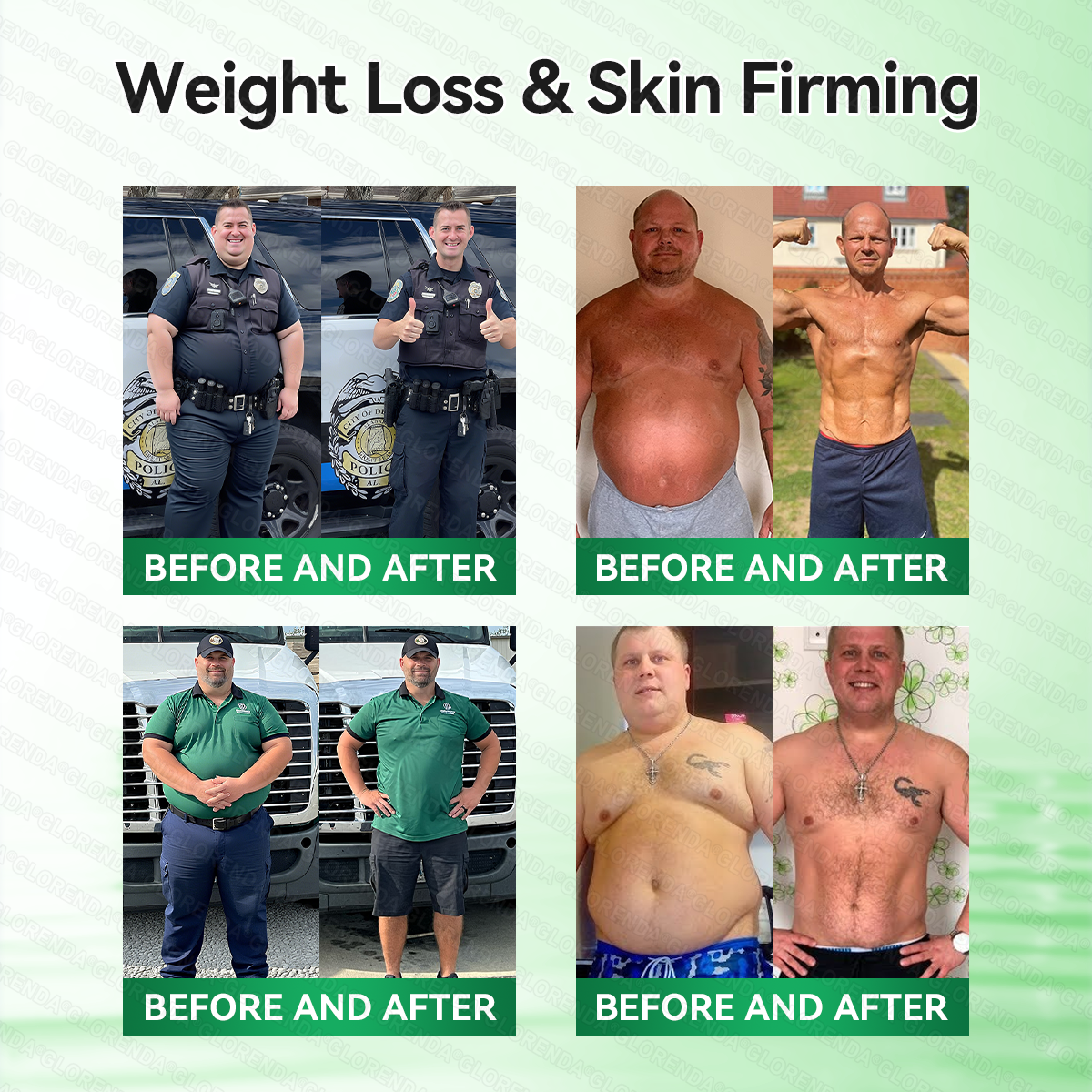 🇿🇦𝑶𝒇𝒇𝒊𝒄𝒊𝒂𝒍 𝑺𝒕𝒐𝒓𝒆 | 🍏🍏 𝐆𝑳𝑶𝗥𝗘𝗡𝘿𝘼® 𝙈𝒐𝒓𝒊𝒏𝒈𝗮 · 𝗕𝗲𝗿𝗯𝐞𝐫𝐢𝐧𝙚 × 𝙉𝑨𝑫+ 𝟏𝟎-𝙞𝙣-1 𝘼𝒅𝒗𝒂𝒏𝒄𝒆𝐝 𝐍𝐚𝐧𝙤 𝙈𝙞𝙘𝙧𝙤𝙣𝒆𝒆𝒅𝒍𝐞 𝐏𝐚𝐭𝙘𝙝(𝐉𝐮𝐬𝐭 𝐨𝐧𝐜𝐞 𝐚 𝐝𝐚𝐲, 𝐯𝐢𝐬𝐢𝐛𝐥𝐞 𝐜𝐡𝐚𝐧𝐠𝐞𝐬 𝐢𝐧 𝟕 𝐝𝐚𝐲𝐬） ✅ 𝐅𝐨𝐫 𝐨𝐛𝐞𝐬𝐢𝐭𝐲, 🅛🅞🅞🅢🅔 🅢🅚🅘🅝,𝐝𝐢𝐚𝐛𝐞𝐭𝐞𝐬, 𝐬𝐥𝐞𝐞𝐩 𝐚𝐩𝐧𝐞𝐚, 𝐣𝐨𝐢𝐧𝐭 𝐢𝐬𝐬𝐮𝐞𝐬, 𝐚𝐧𝐝 𝐦𝐨𝐫𝐞